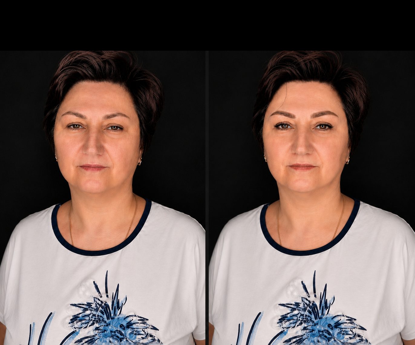 Брови — результат